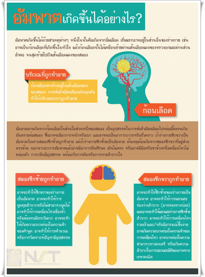 อัมพาตเกิดขึ้นได้อย่างไร